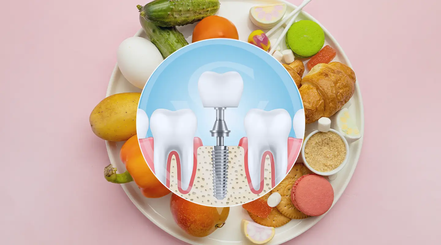 Dental implant recovery process